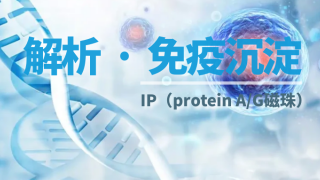 免疫沉淀（IP）实验7大常见问题及解决方案
