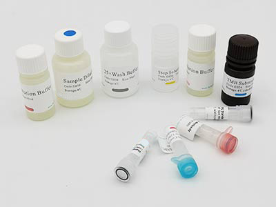 人抗肿瘤坏死因子α抗体(TNF-α-Ab)酶联免疫elisa试剂盒